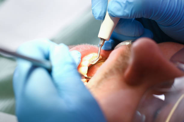 Best Emergency Gum Treatment in Mechanicsburg, PA